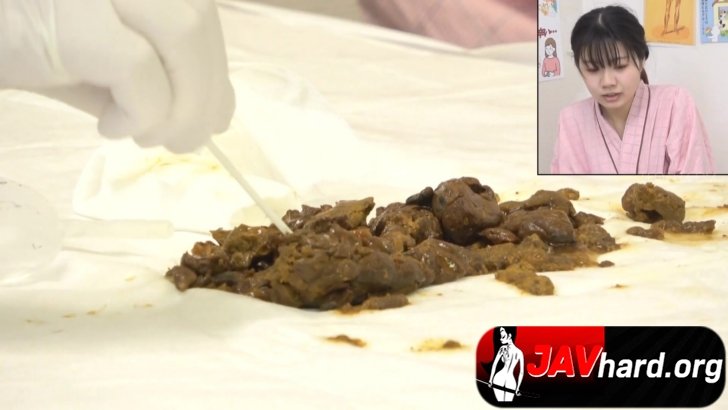 SL-625-Hidden camera at the constipation relief clinic  Stimulating the intestines of a woman wit...